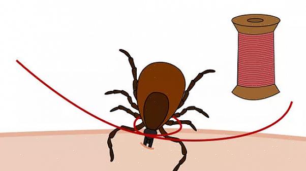 Må du fjerne det forsiktig for å redusere risikoen for sykdom